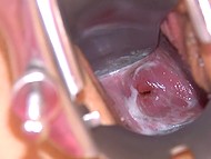 Boyfriend won't come, so the fetching girl uses vibrator and speculum to reach orgasm 9